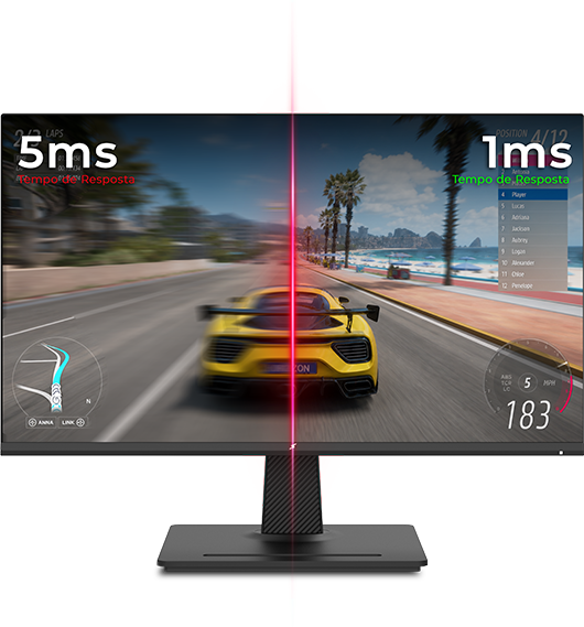 1MS